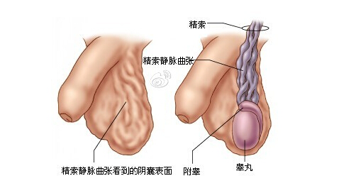 男人的睾丸性疾病有什么