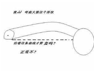 阴茎弯曲