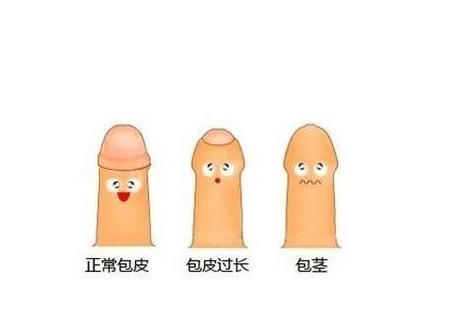 包皮过长为什么会引起早泄